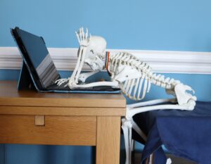 Photo of model skeleton slumped over a laptop